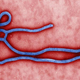 Image for article titled Why is ebola deadlier than other viruses?